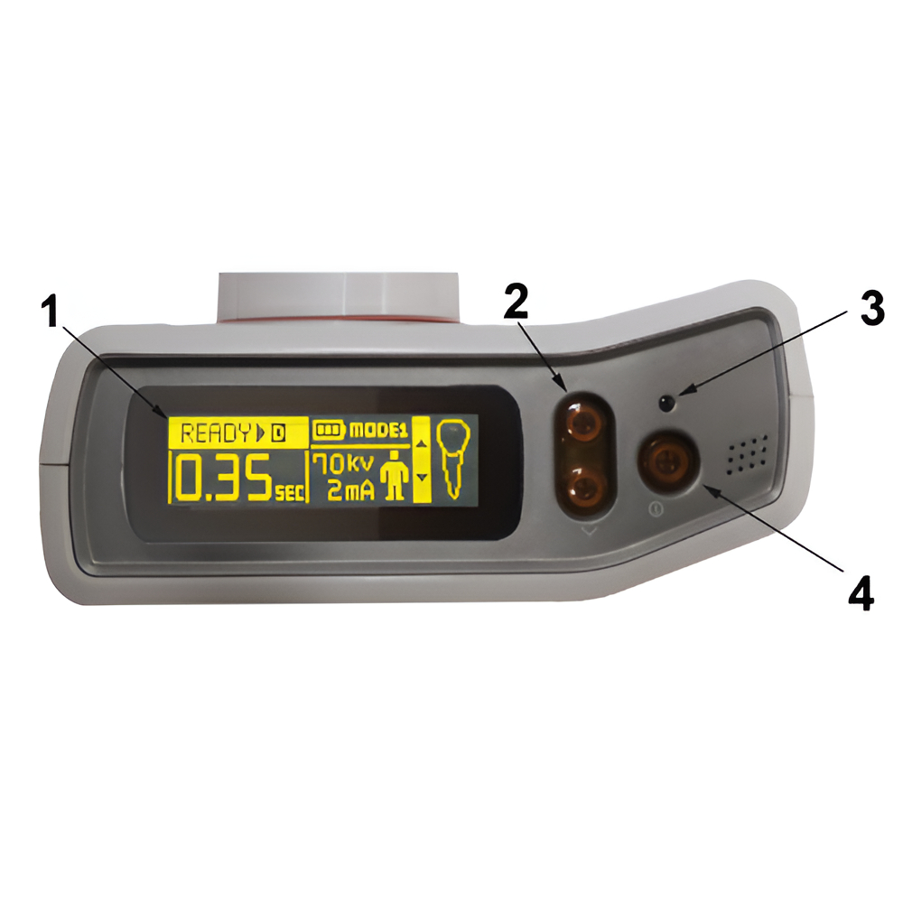 MobileX Handheld X-Ray Generator with 2 Year Warranty